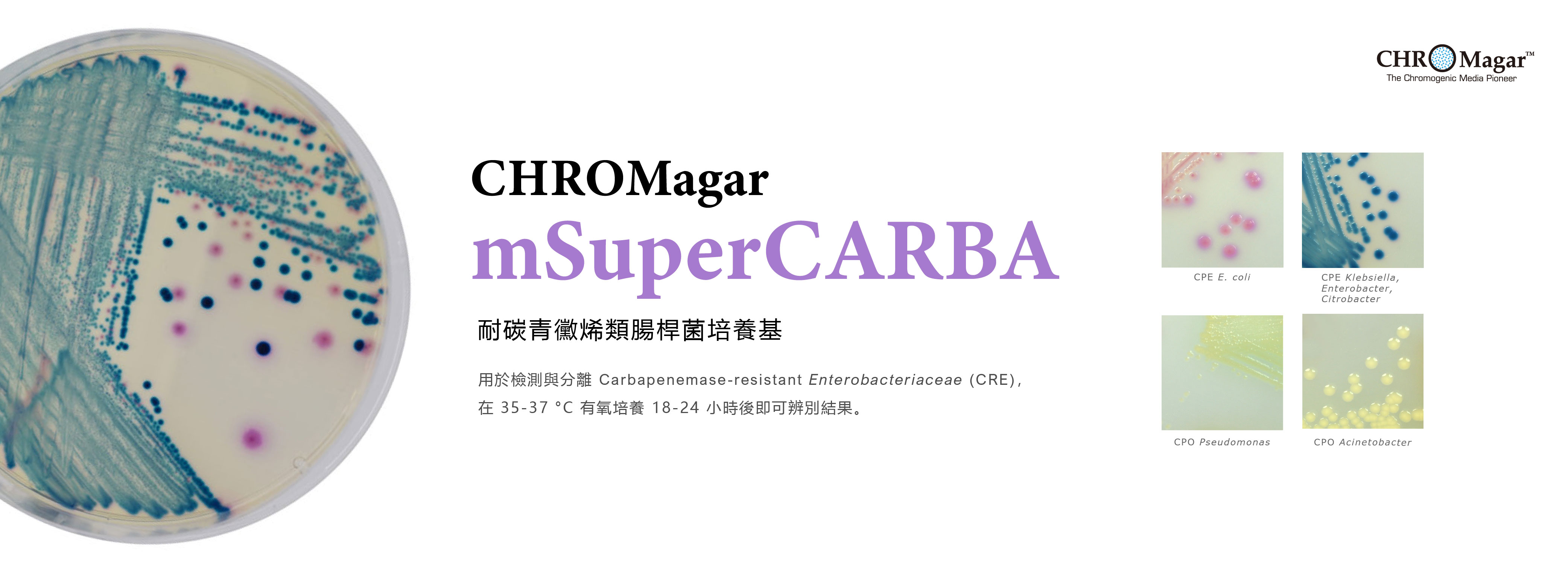 CHROMagar mSuperCARBA