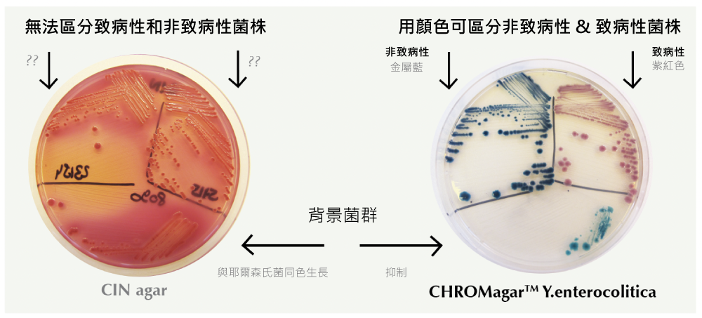 Y.-enterocolitica-顏色區分菌株.png